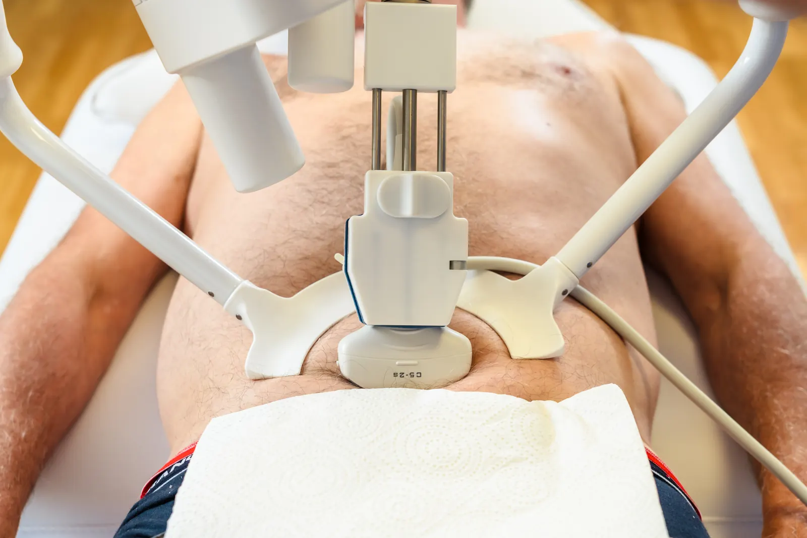 Top view of the robotic probe holder and its probe on a patient's abdomen